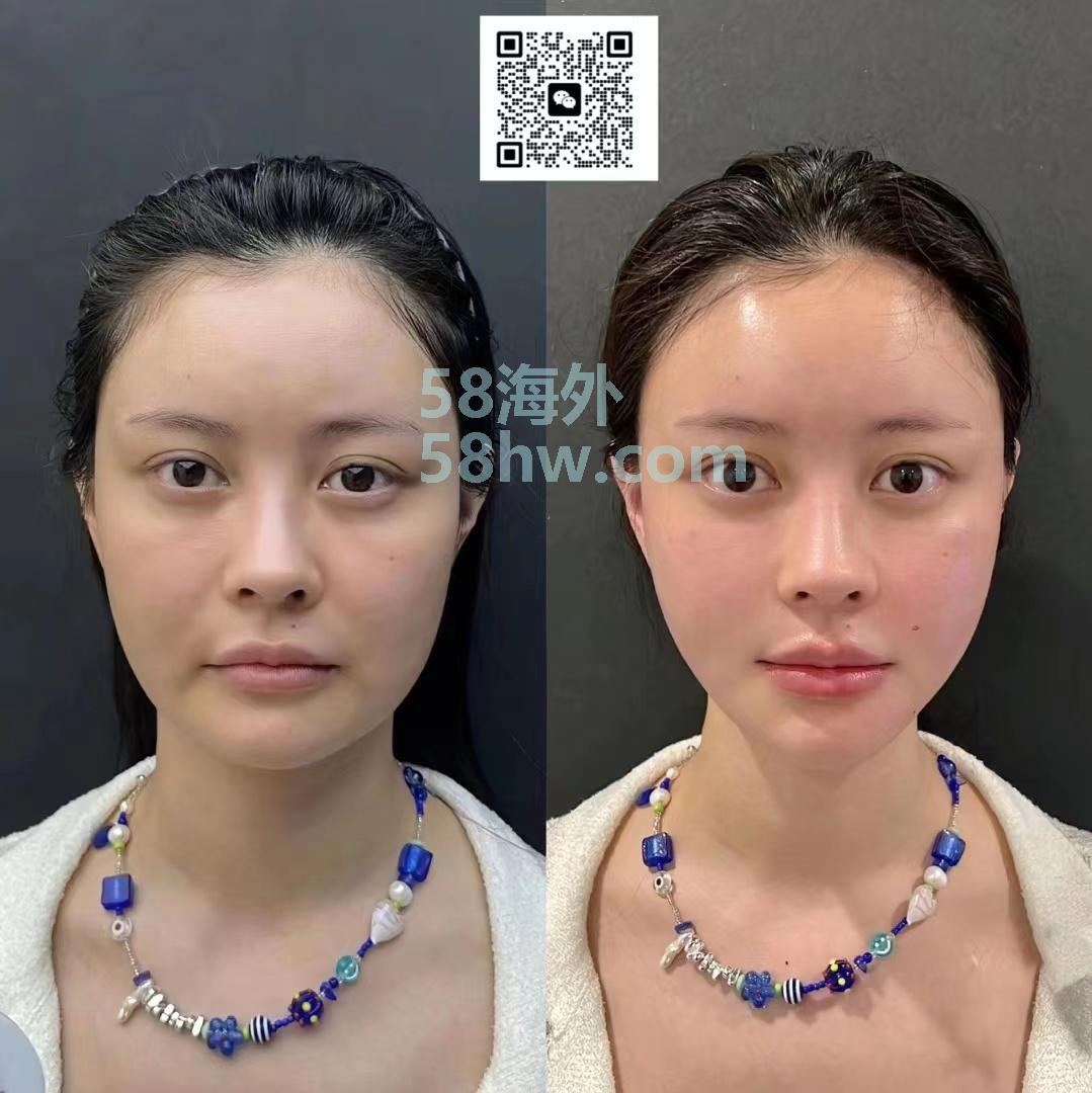印尼🇮🇩雅加达美甲美睫美容